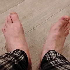 My Feet After a Long Day