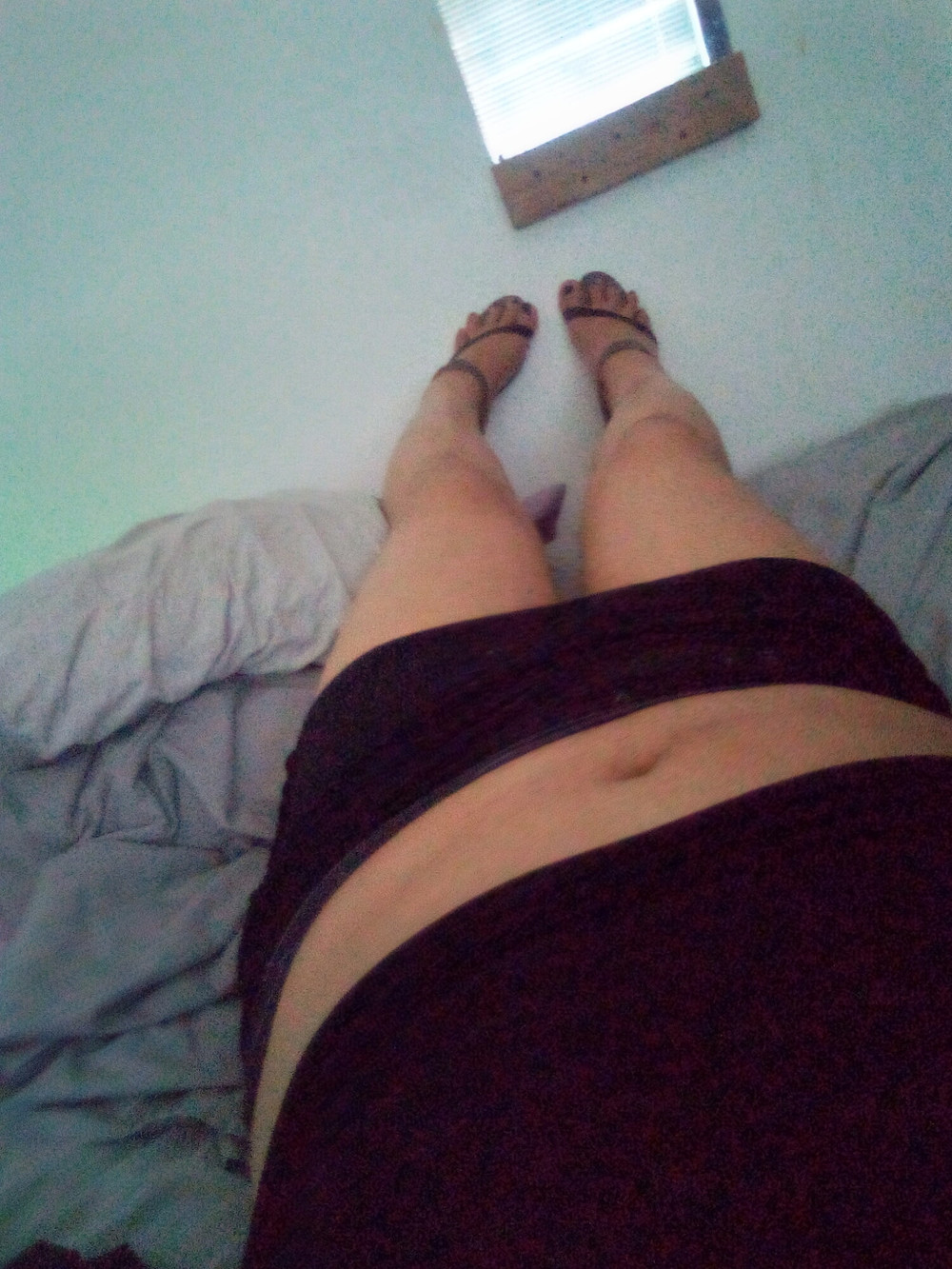 Overhanging toes, ankle straps, toe spreading.  #3