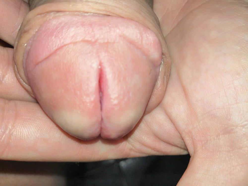 Split penis #3
