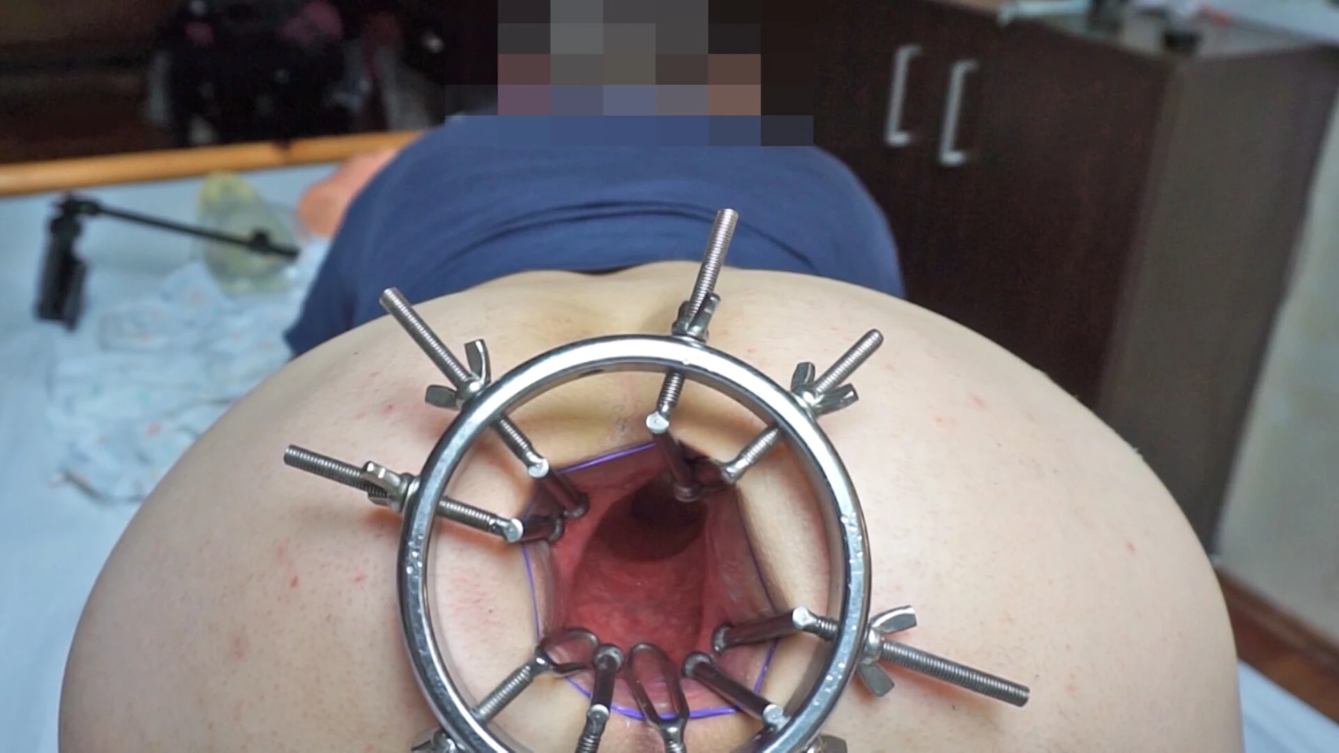 Anal spreader pt. 3:on my way to 10,5cm...a long way! #5