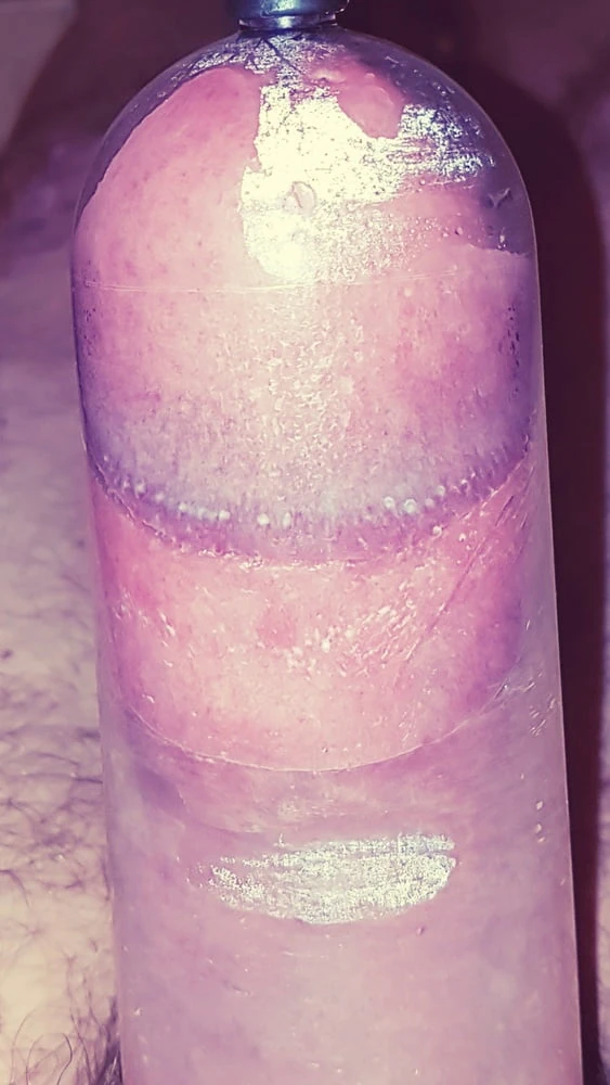 Penis pump #5
