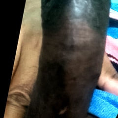 Subincision 