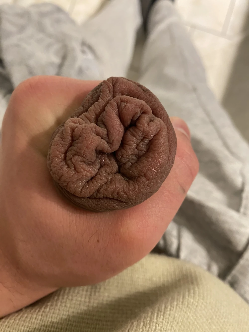 Extreme foreskin stretching porn #3