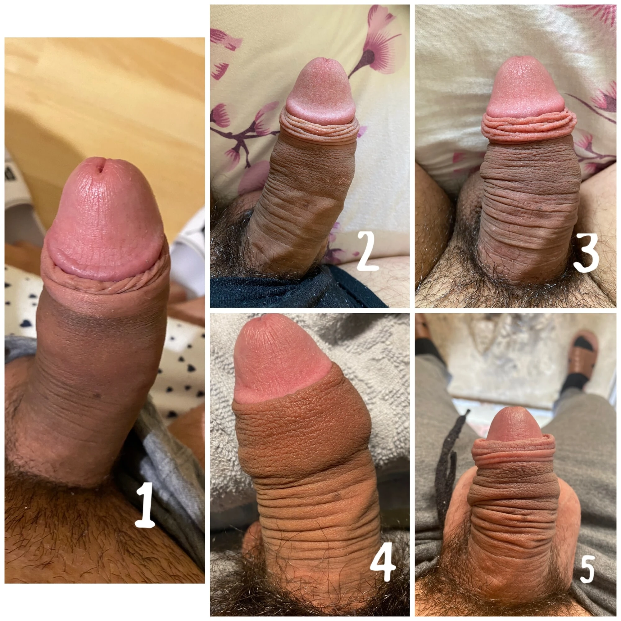 Regangan kulup