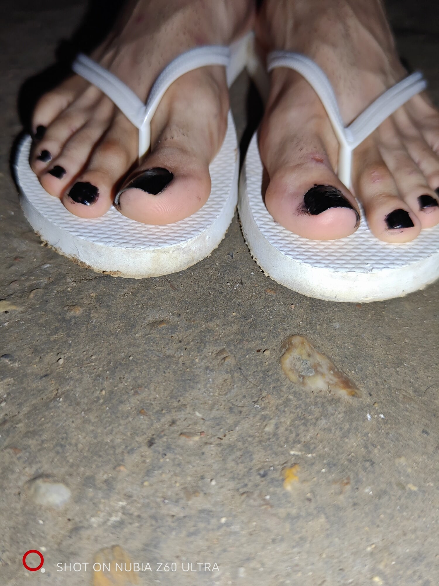 Feet CSG