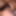 So Close So Hairy