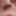 Penis