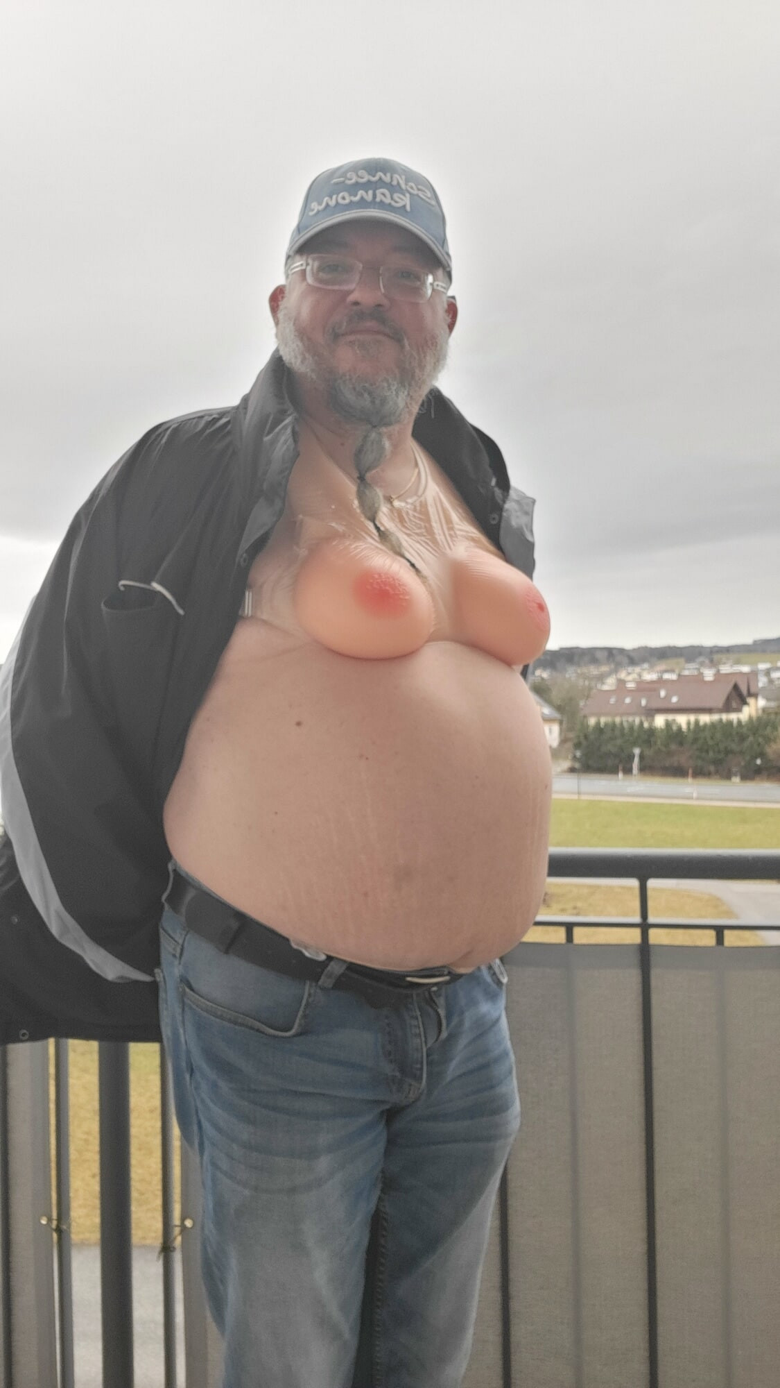 Mikropenis Michael Skotniks Feminiesierung - aktuell und erw