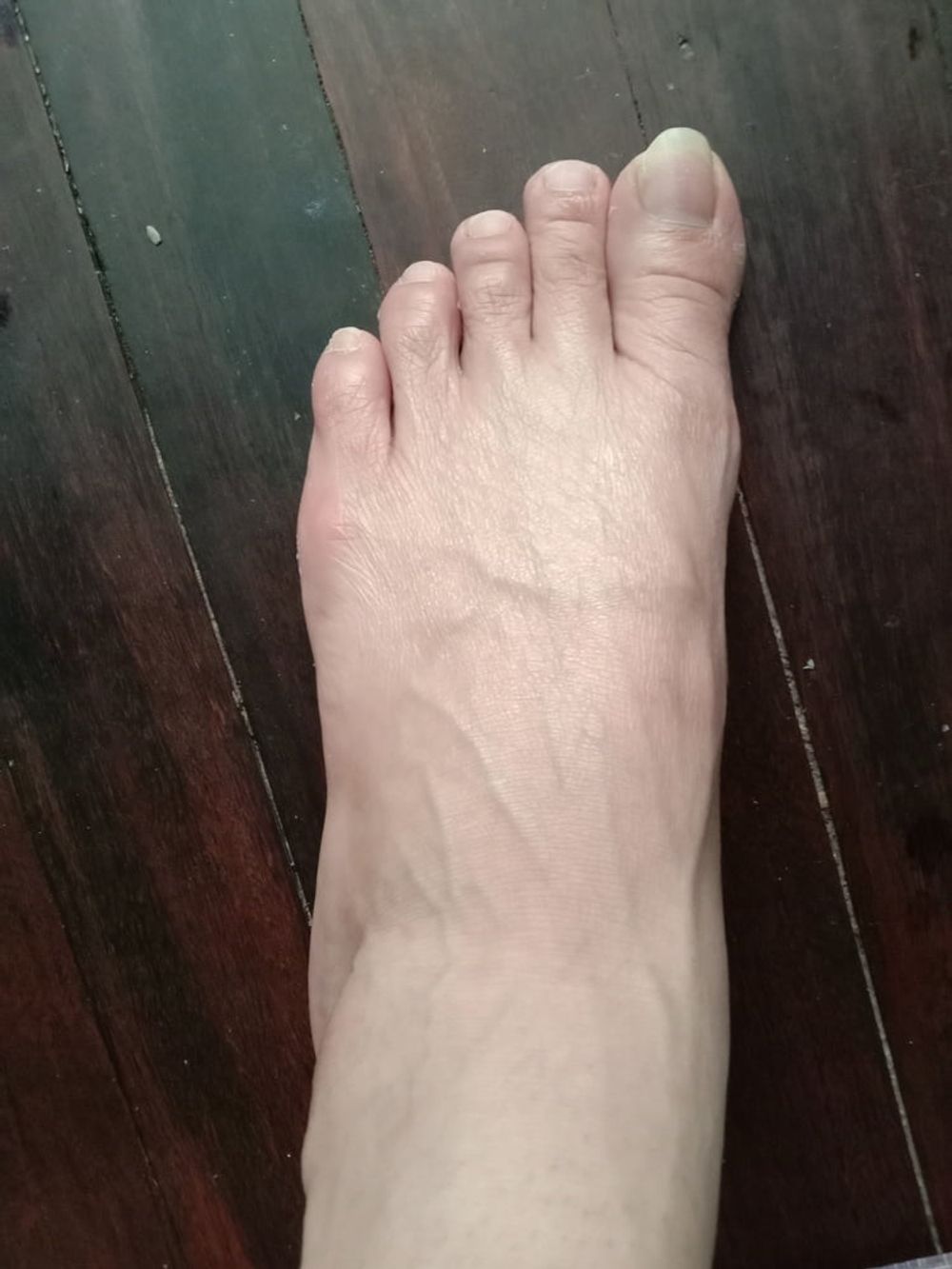 foot