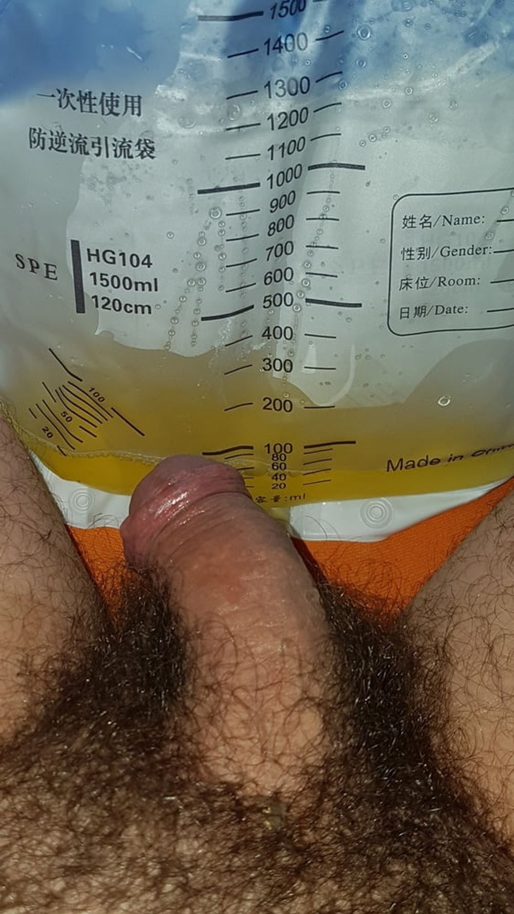 Catheter sounding with my urine 2 #6