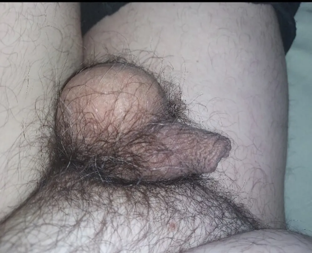 Very small penis #5