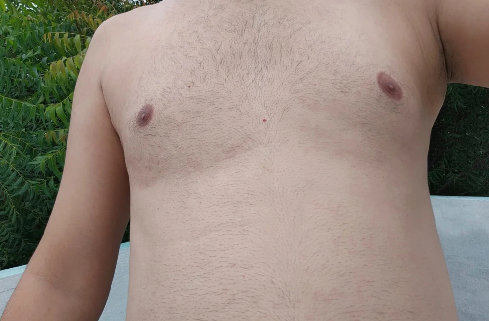 male nipple #3