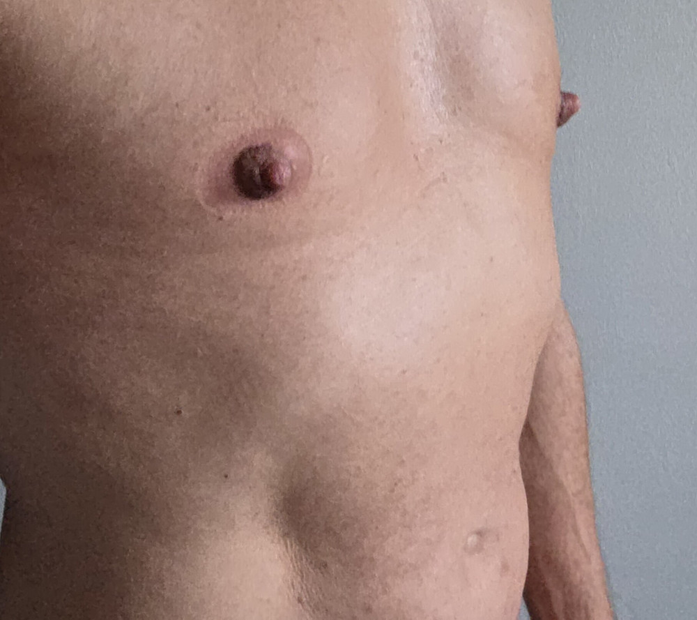 NIPPLES PUMPED 5 #15