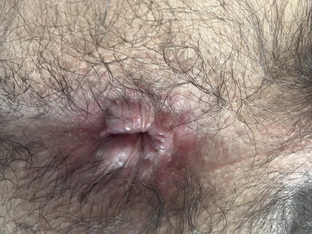 hairy hole