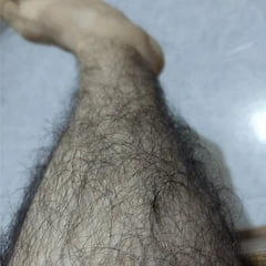 Peludo