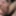 Fingering subincision deep #3