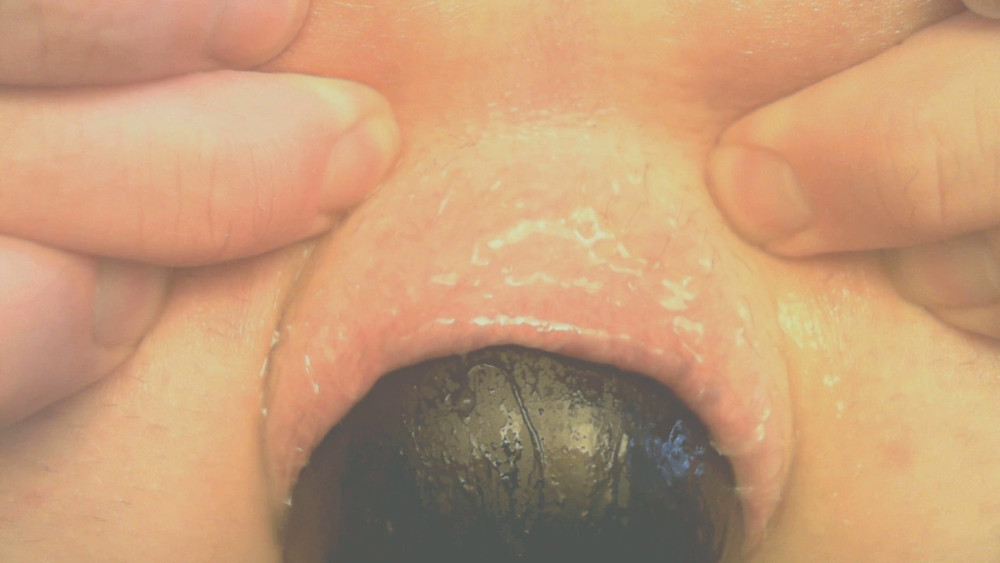 my butthole under pressure