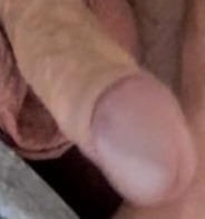 Penis