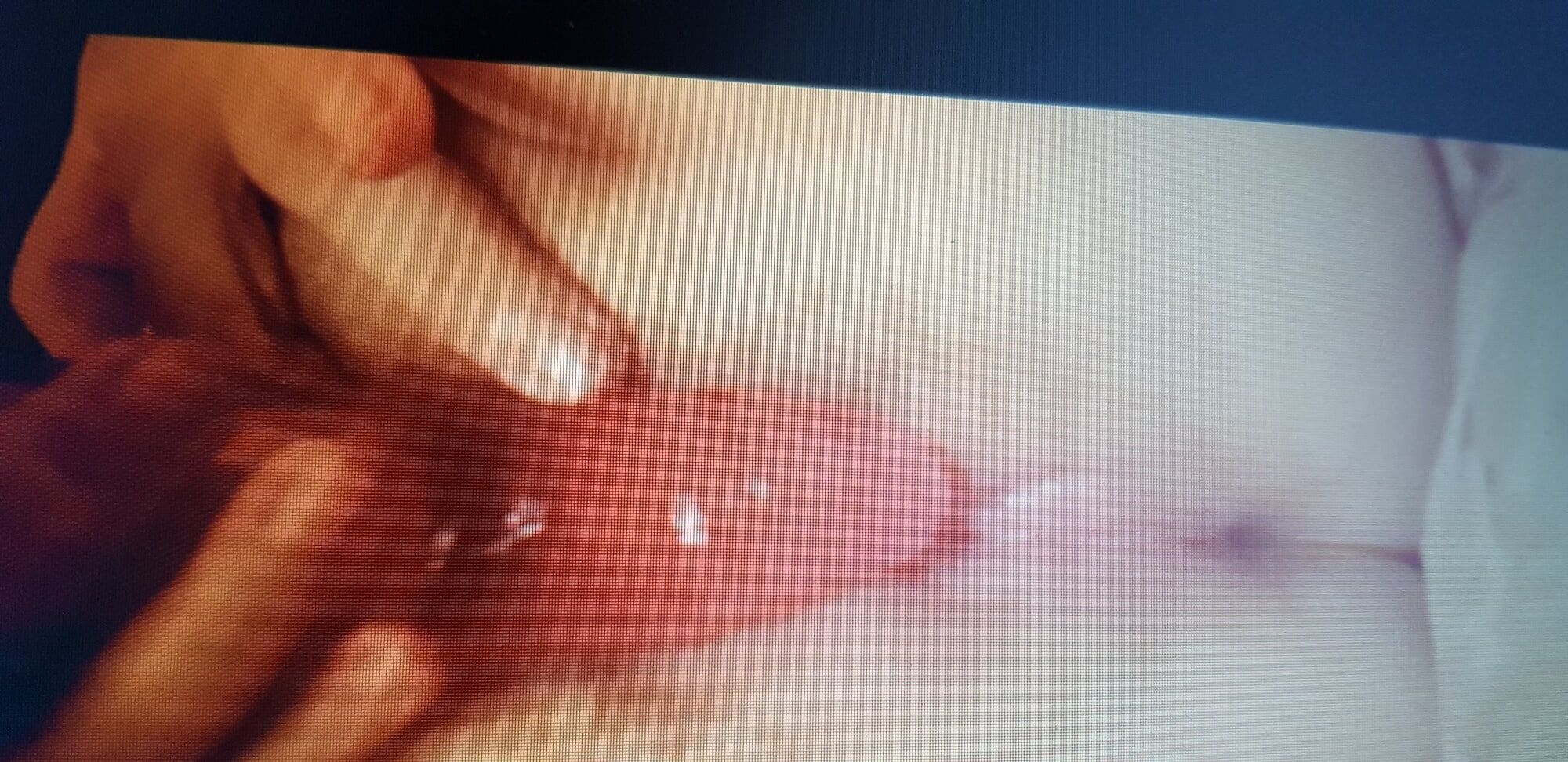 new pictures of my husband's little cock, it's so nice to su #11