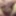 Fingering subincision deep #5