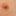 Gland #4