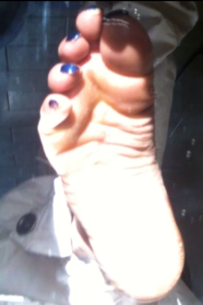 Blue toenails under sun ray #30