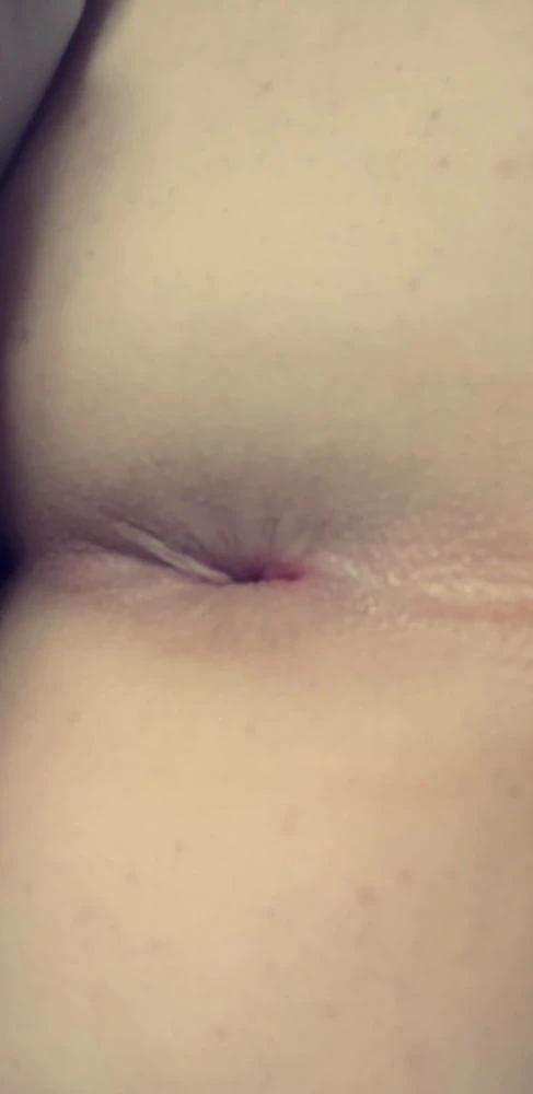 Closeups