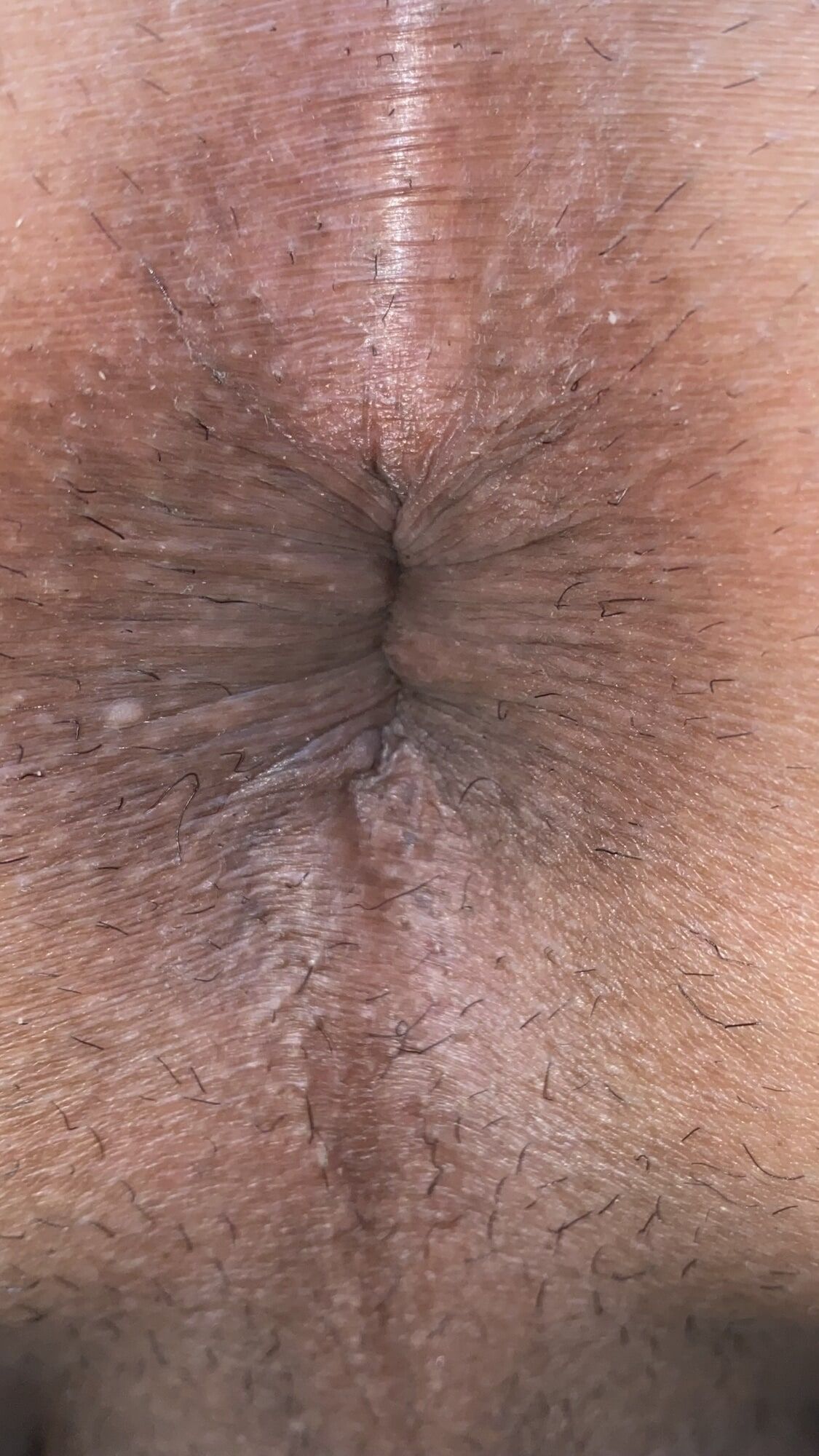 Close-up of a man's anus #13