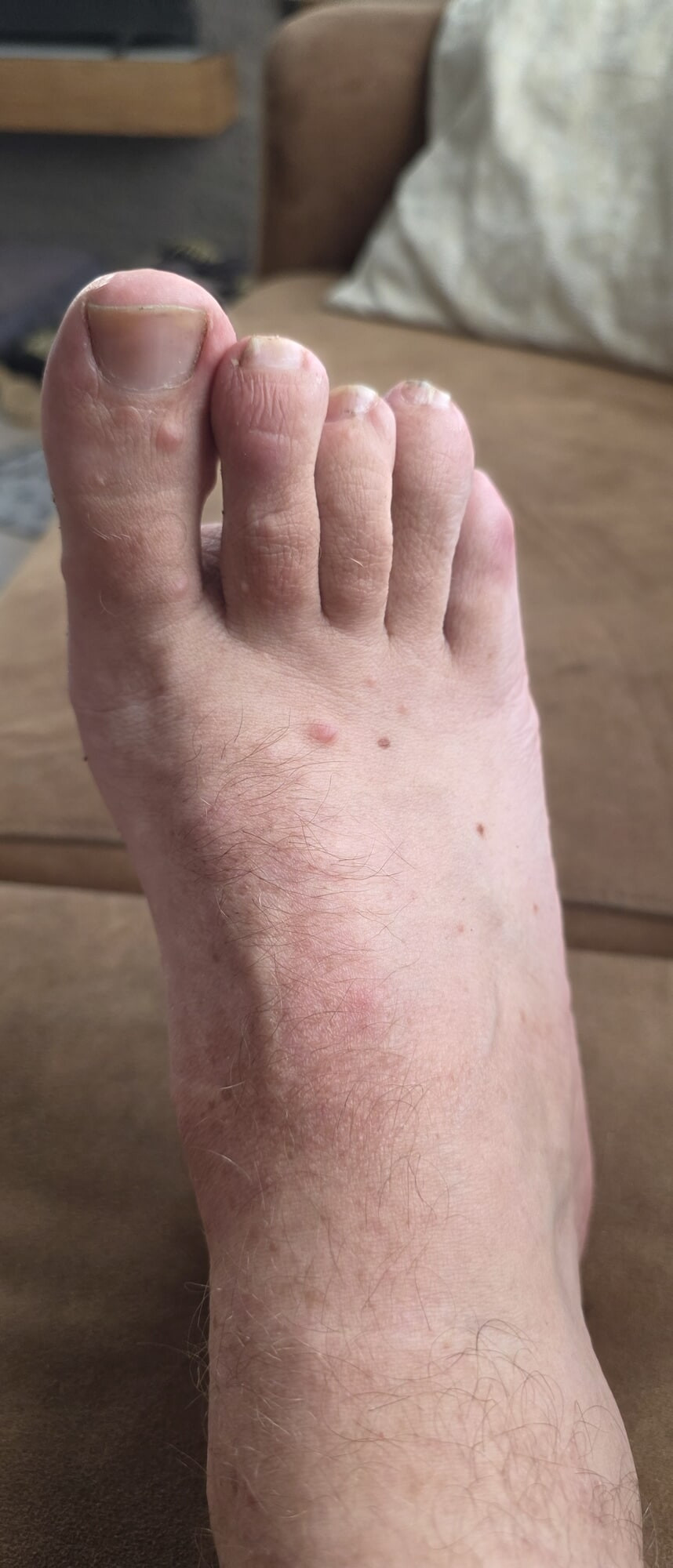 My feet #3