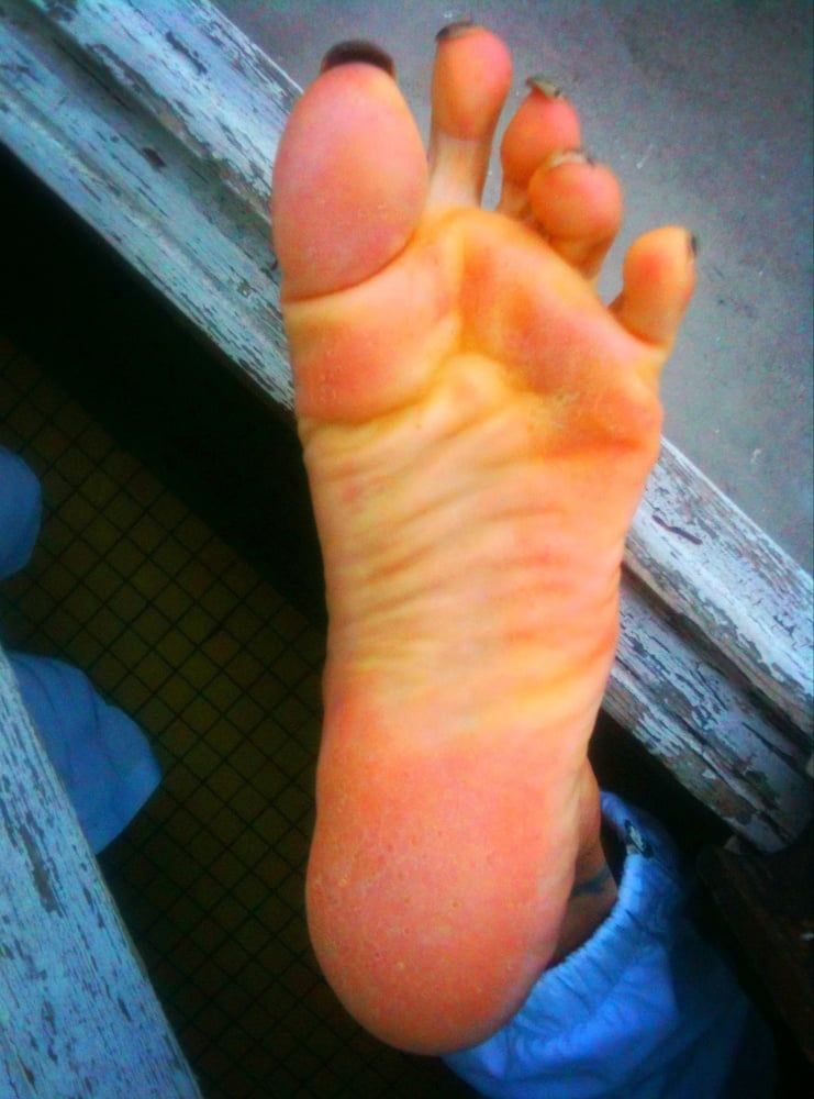 Asian ts feets, soles, toenails mix #60