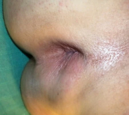 My ass ready for cock