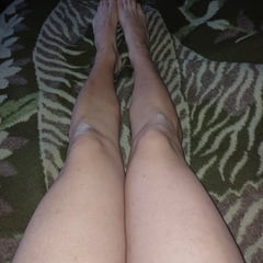 Legs