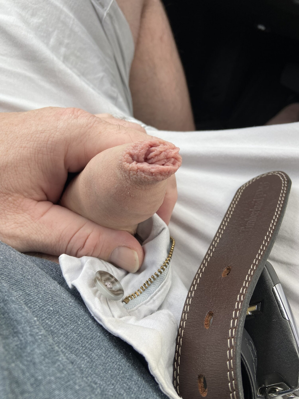 Foreskin #3
