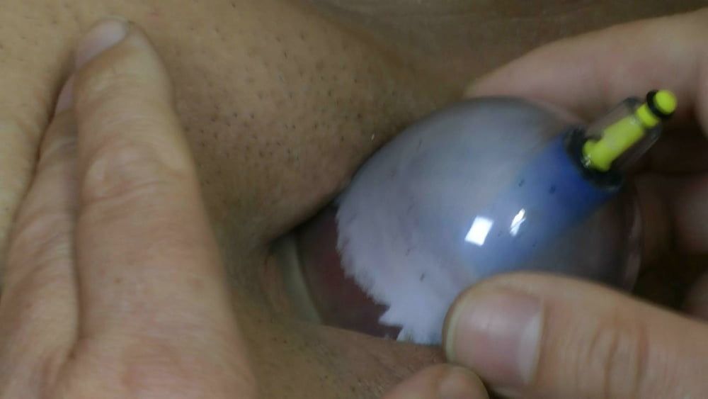 Nipple and clit cupping #38