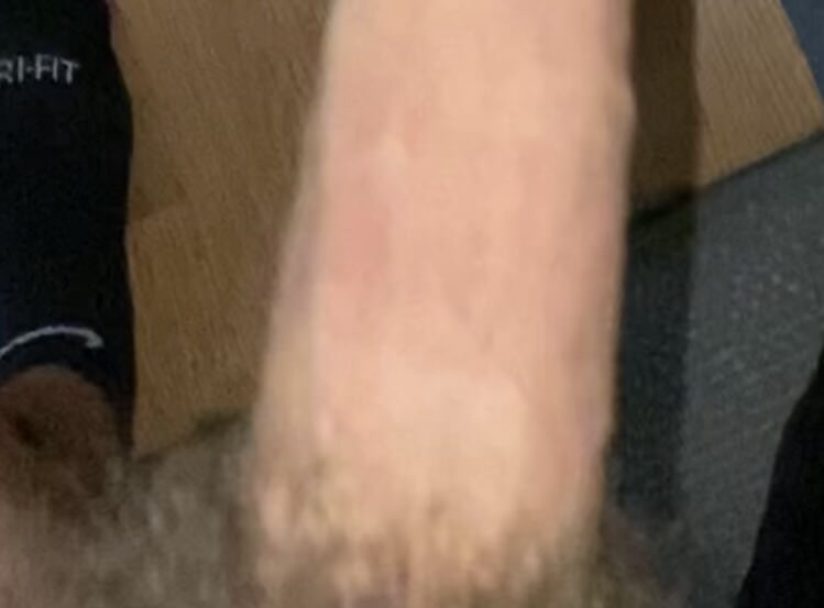 medium wiener 