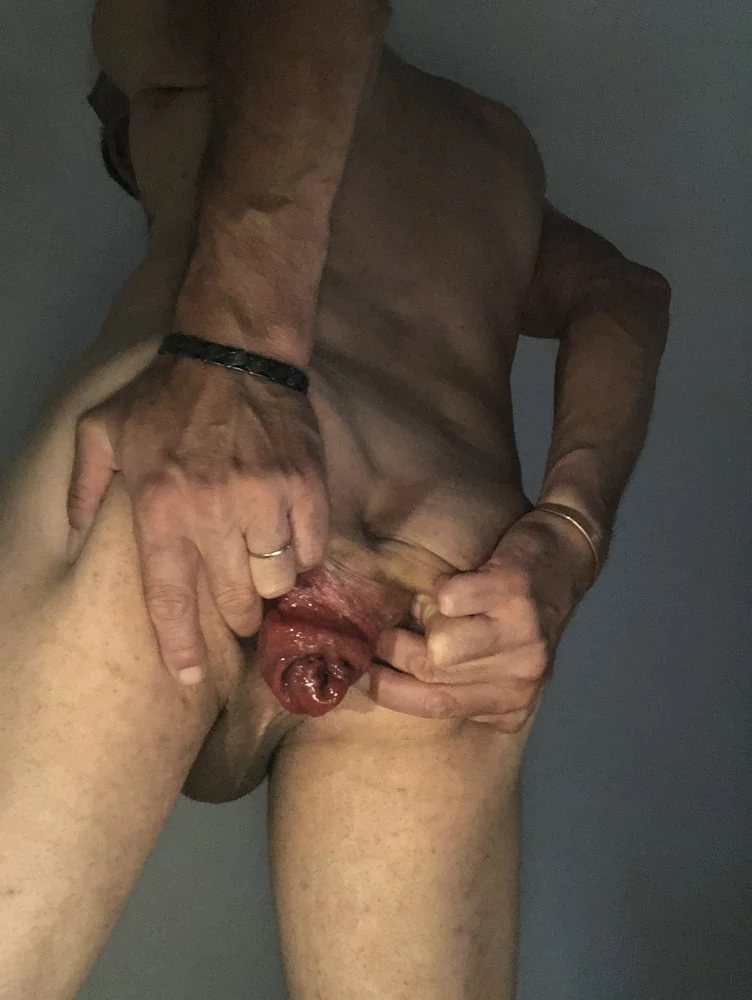 my anal prolapse is changing incredibly #35