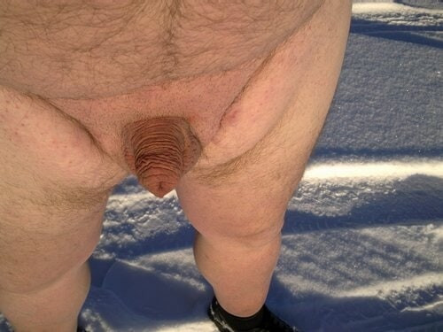Micropenis #6