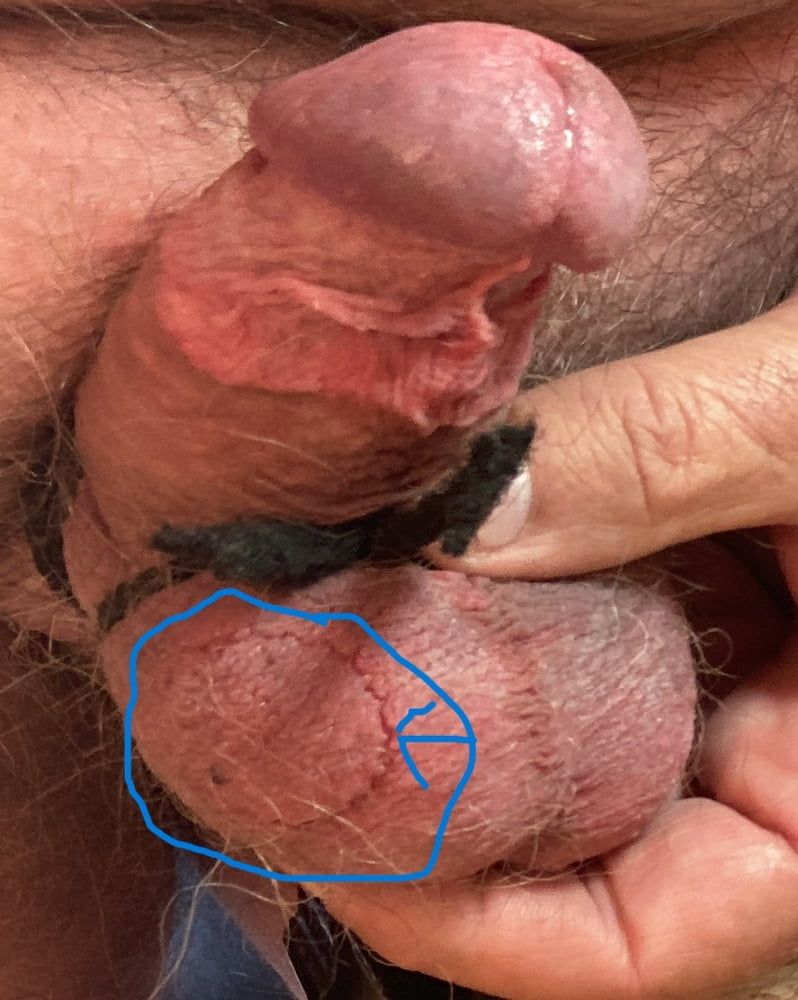 My tortured cock and balls pics #6