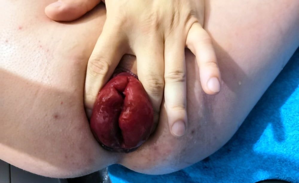 extreme prolapse pumping #9
