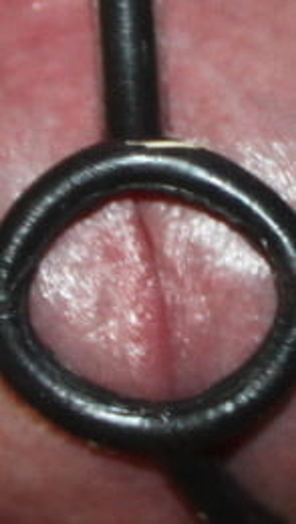 Cock rings #7