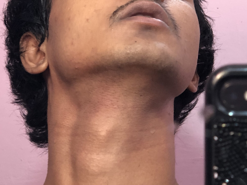 Pics of my slim  body  #19