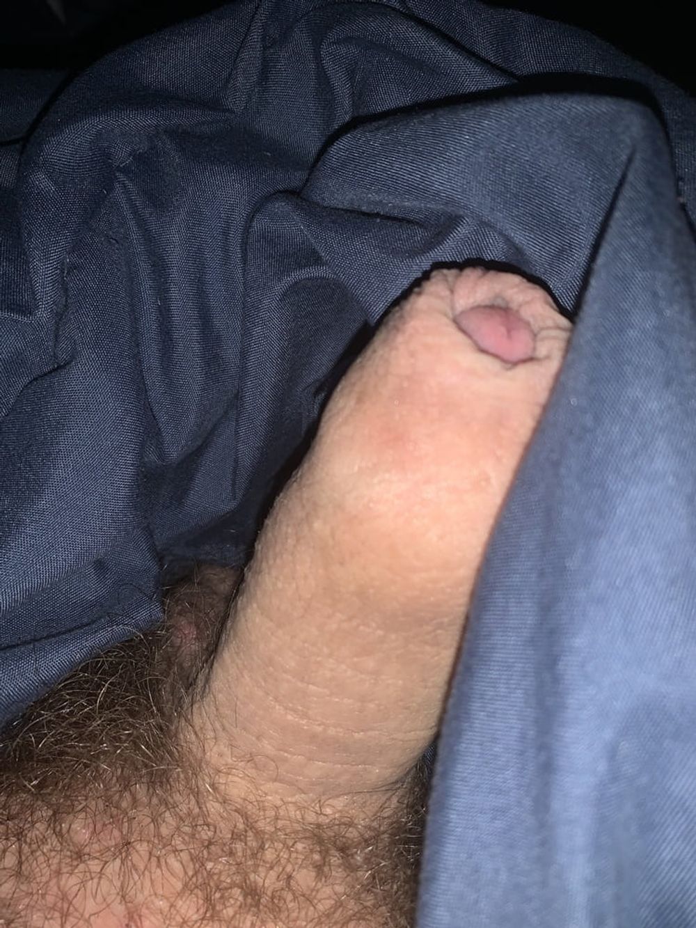 My foreskin #2