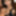 Teaser