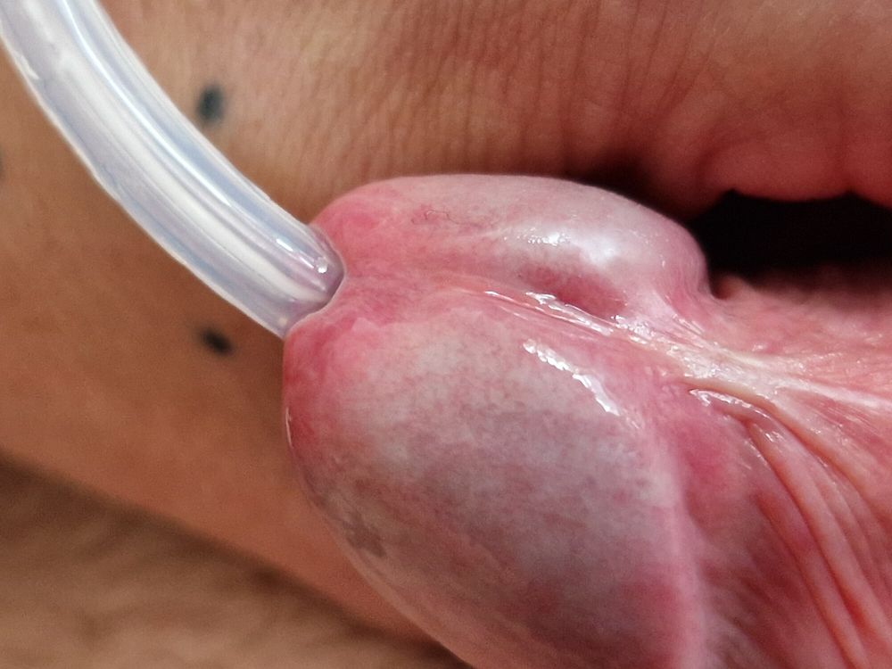 Urethra play and syringe close up photo&#039;s  #5