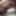 Tugging my foreskin - Foreskin restoration - Aug 2025 #5