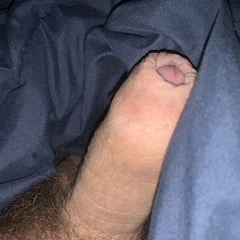 My foreskin