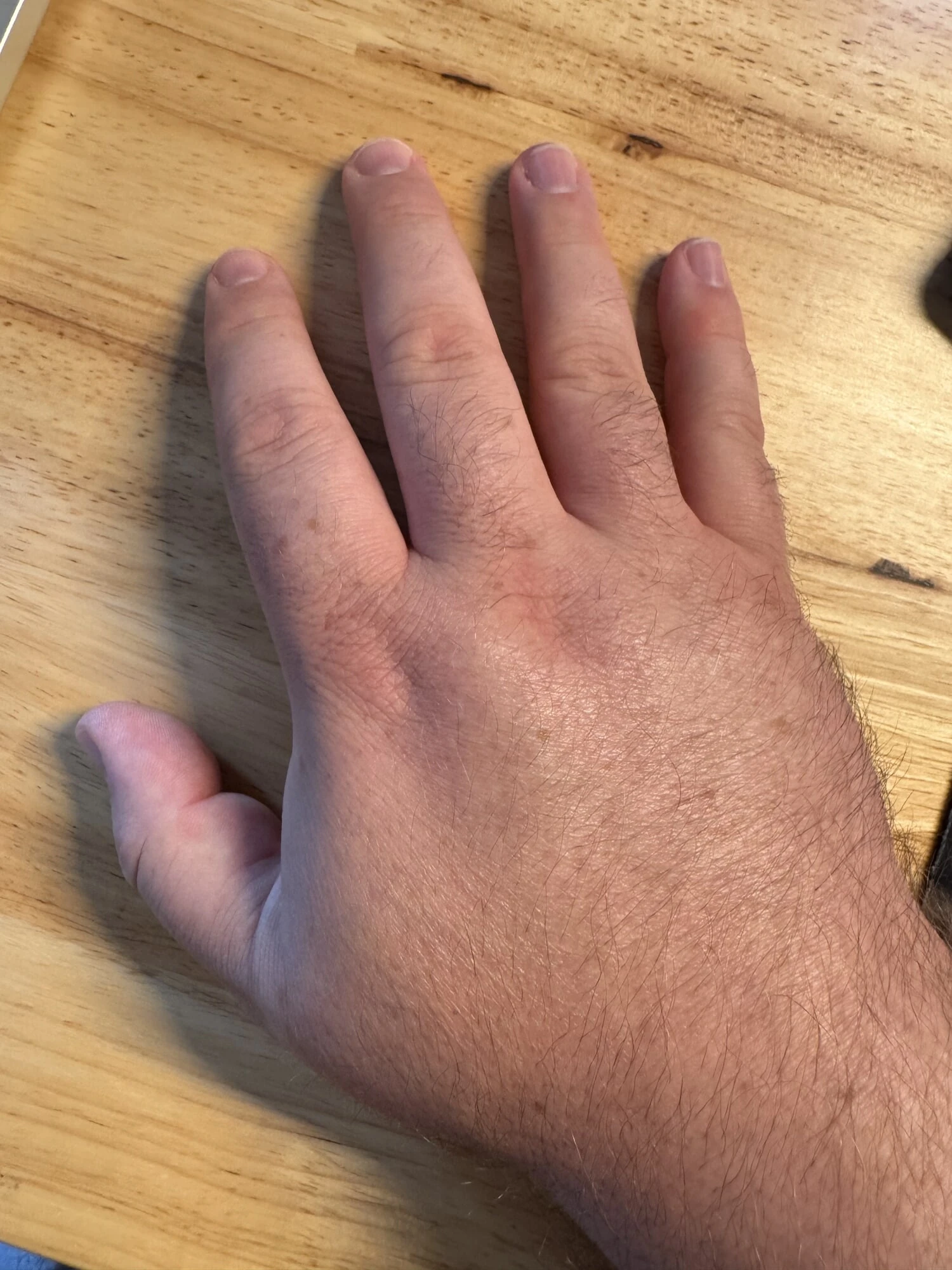 Hands