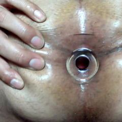 First plug