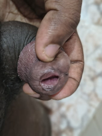 Closeup