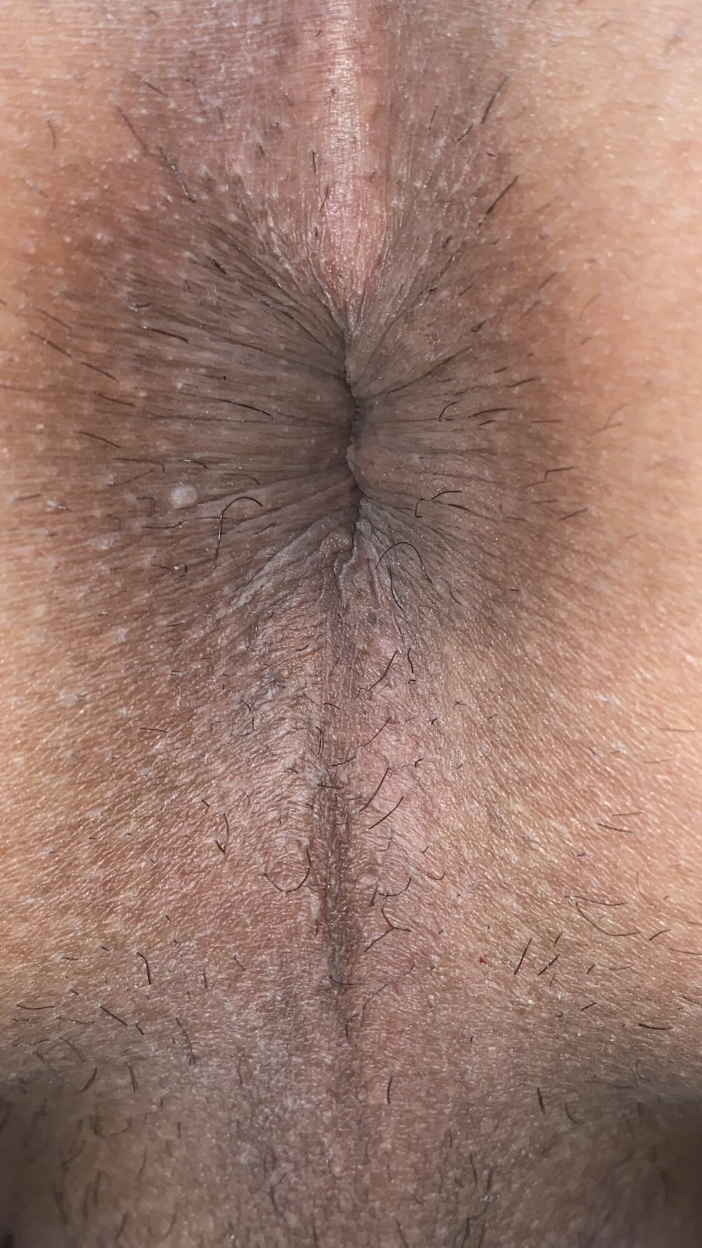 Close-up of a man&#039;s anus #13